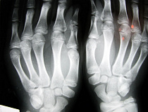 За подделку справки на хирурга больницы в Калининграде завели уголовное дело