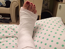 Врио министра развития инфраструктуры Калининградской области сломала ногу