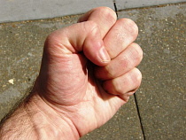 Парень сломал челюсть мужчине, которому не понравилось его поведение