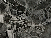 19-летнему сломали нос после того как он вступился за друга