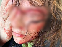 Рекламный щит ранил женщину у острова Канта в Калининграде