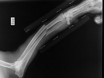 Женщине сломали руку за упрёк в пьянстве