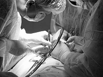 Больному раком в Калининграде нашли способ не вырезать почку