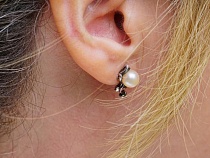 Калининградка откусила часть правого уха своей оппонентке