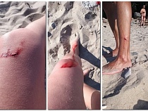 В Зеленоградске купающиеся порезались о железные штыри