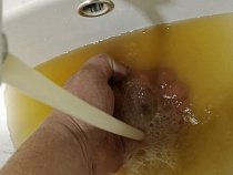 У жителей Озёрска рвота от одного взгляда на воду из-под крана
