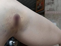 В Прибрежном мирно шедшую домой девушку зверски искусали