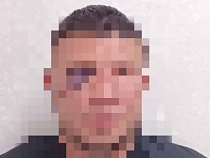 Житель Черняховска сжёг в Калининграде чужую машину