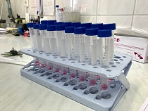 В Калининградской области выявили ещё 155 инфицированных