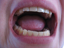 Оскорбившую соседей пенсионерку оштрафовали на тысячу рублей