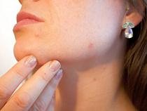 «Секрет молодости» не удовлетворил клиентку в Советске