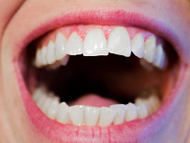 Рецидивист сломал челюсть студенту у ночного клуба в Калининграде