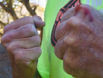 В катакомбах Зеленоградска двое парней ослепили, а после ограбили мужчину