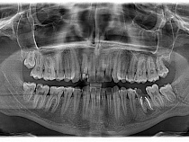 В Калининграде осужден сломавший челюсть сослуживцу военнослужащий