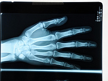 Капремонт рентгенкабинета в Немане обойдется не дороже 1,3 млн рублей