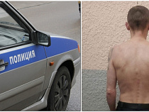 Подробности пожара в жилом доме в Советске: квартиру поджег бывший уголовник