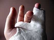 Лишившаяся пальцев калининградка отсудила у работодателя 300 тысяч рублей