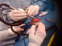 Стало известно о пяти экстренных операциях в Калининграде   