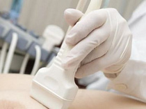 Калининградка – Алиханову: «Я против, чтобы меня снимали голую»