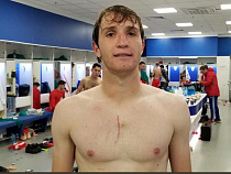 Матч Россия – Швеция оставил кровавый след на груди Марио Фернандеса