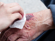 Пьяный мужик на мопеде сбил односельчанку