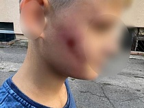 Избивший ребёнка в Зеленоградске попал на контроль Москвы