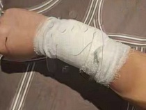 В Гурьевске девочка устроила в школе кровавую поножовщину