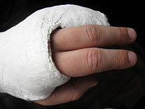 Калининградка получила переломы во время полета в аэродинамической трубе 