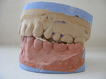 Калининградец выбил соседу три зуба ногой