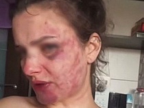 В Калининграде избитая мать троих детей умоляет людей о спасении 