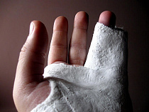 СК проверяет информацию о ребенке, сломавшем руку в детском клубе